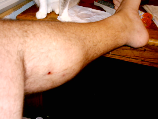Close-up of a hairy human leg with a small red wound on the calf, resting on a wooden surface. A cat's paws are visible in the background