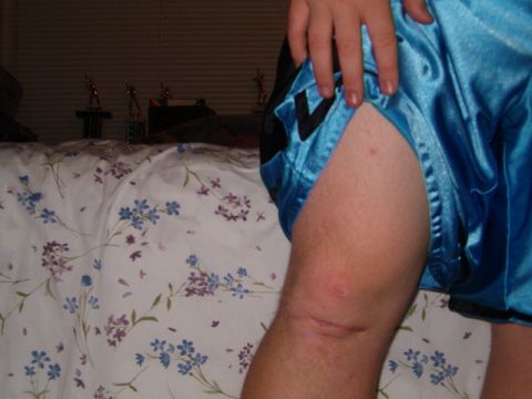 1996 Ford Bronco - A person's leg is shown in the foreground, with blue shorts and visible scars. Trophies are visible in the background.