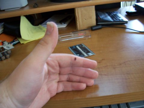 1995 Ford Bronco - Close-up of an open palm held over a wooden desk, apparently showing a small splinter or dark speck on a finger, with a keyboard, calculato…