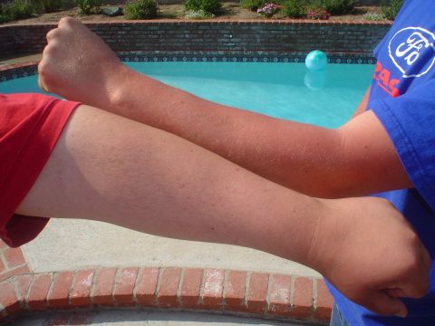 1993 Ford Taurus - Sunburned and tanned arms are shown in front of a swimming pool with a blue ball floating.