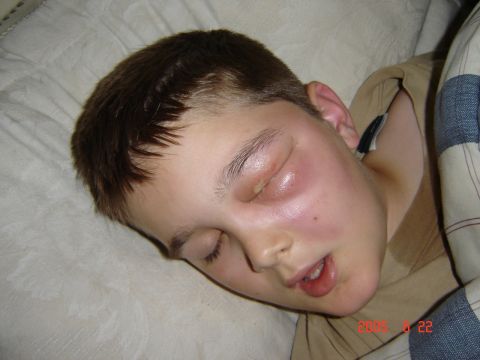1993 Ford Bronco - A young person sleeps with a visibly swollen eye and cheek. The Supermotors.net logo is in the lower right corner.