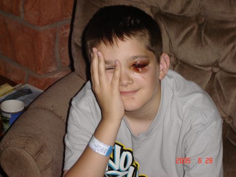1993 Ford Bronco - A young boy sits with a bruised eye, a hospital wristband visible on his arm.