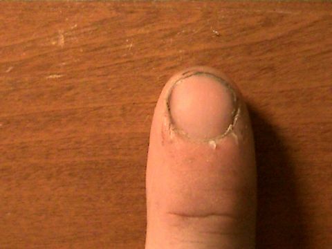 1977 Ford F-150 - unsmashed finger