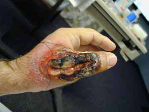1990 Ford Bronco - A severely injured hand is shown, with medical attention evident. Text from a watermark is visible at the bottom.