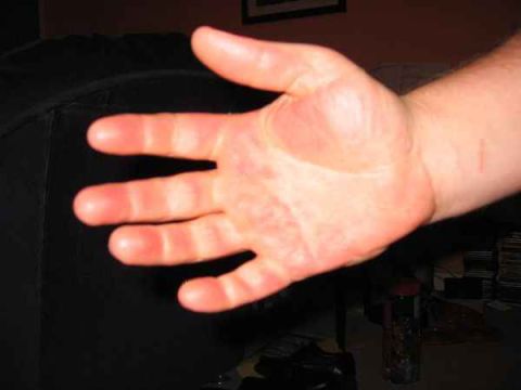 1989 Ford Bronco - A human hand is shown with fingers extended, obscuring any potential vehicle details in the background.