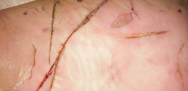 Close-up of a damaged, pinkish vehicle body panel with deep scratches and abrasions. Supermotors logo visible