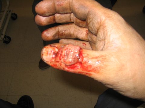 1978 Ford Bronco - A close-up view of a bloody foot.