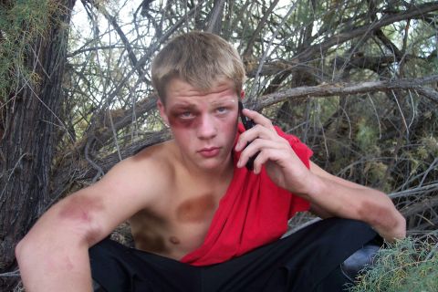 1989 Ford Bronco - A young man with visible injuries, including a black eye and bruises on his arms, sits in a wooded area while speaking on a cell phone.