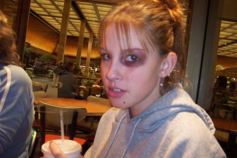 1989 Ford Bronco - A young woman with a black eye is seen in a public place, holding a beverage.