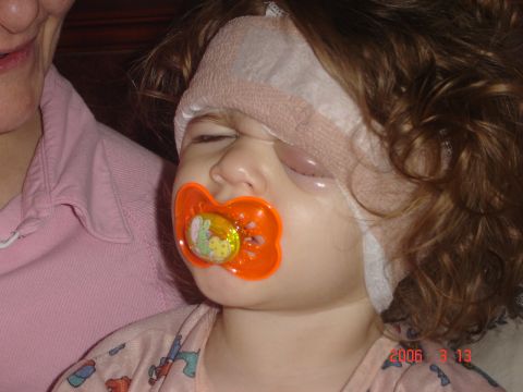 1993 Ford Bronco - A child with medical bandages and a pacifier is shown in this close-up photo.