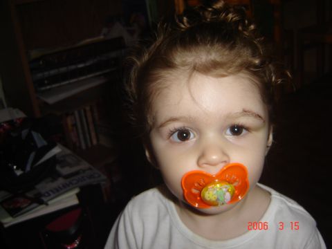 1993 Ford Bronco - Toddler with an orange pacifier and a bruise on forehead, dated 2006-03-15.