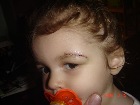 1993 Ford Bronco - A close-up of a child's face shows a cut above their eyebrow, with a pacifier in their mouth.