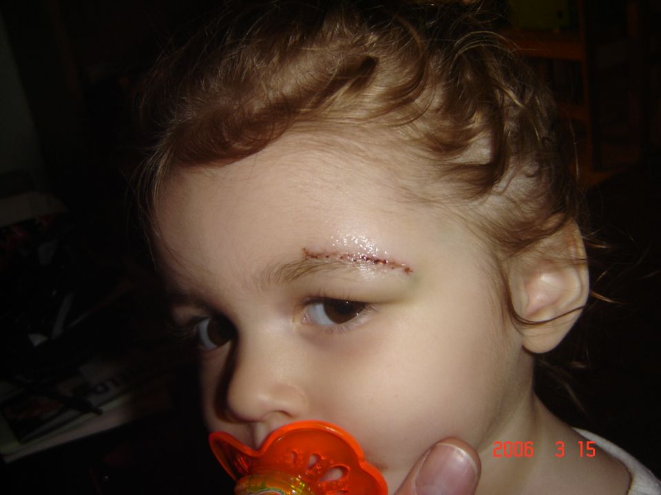 Kid's eyebrow cut, with a pacifier and a watermark