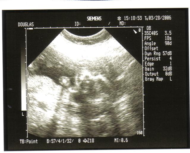Ultrasound image with medical data displayed on screen