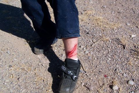 2003 Jeep TJ - A person's leg shows a deep gash with blood, clad in jeans and a motorcycle boot, standing on a gravelly surface.