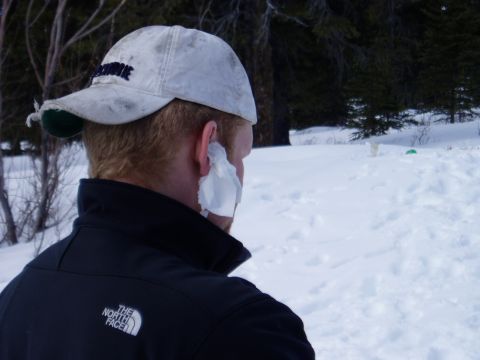 2000 Ford E350 - A person stands in a snowy outdoor environment, wearing a cap and jacket with tissue on their face.