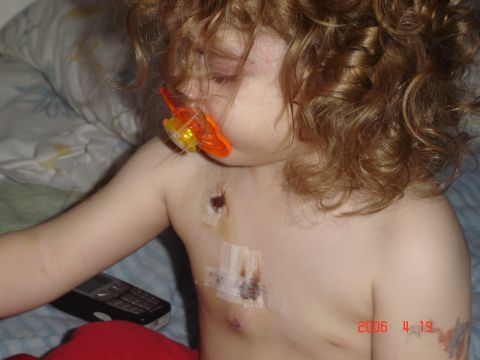 1993 Ford Bronco - A child with a pacifier and medical dressings on their chest is shown with a cell phone nearby.