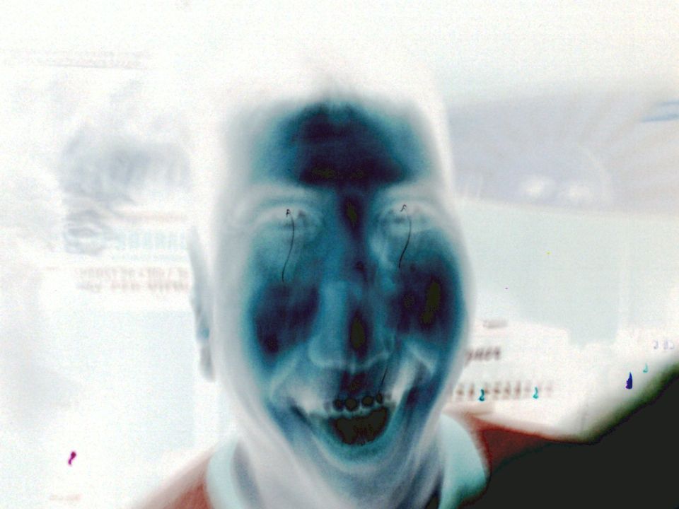 Distorted face with wide smile and dark eyes
