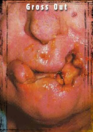 1979 Ford Bronco - This image shows a graphic close-up of a severely damaged face, with the text 'Gross Out' and a website address visible.