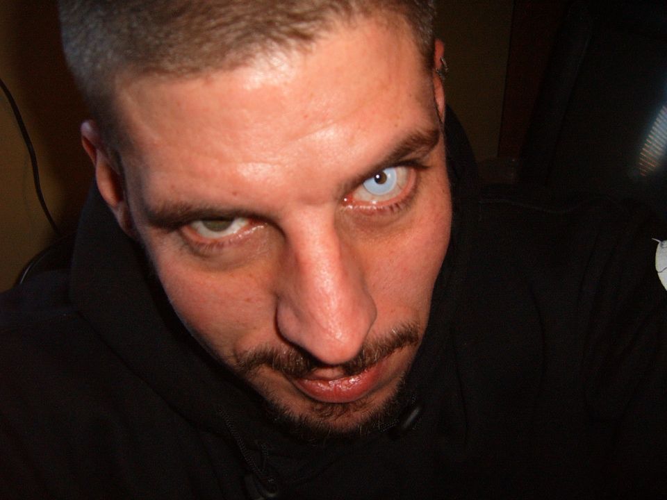 Man with one blue eye and one brown eye, wearing a black hoodie