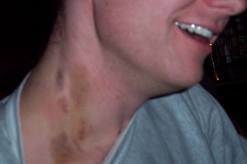 2001 Ford Crown Victoria - Brent with his girlfriend lamp attack