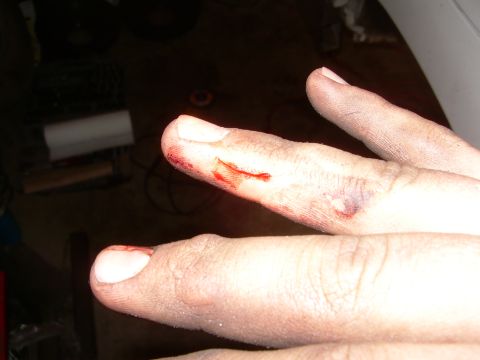 1993 Toyota 4Runner - Close-up of injured fingers showing cuts and bruising, with a watermark for Supermotors.net.