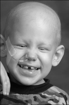 1979 Ford F-150 - A child with a feeding tube and medical tape smiles broadly, showing missing teeth.