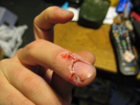 1997 Ford Crown Victoria - Close-up of an injured finger with a cut and blood, with a remote control in the background.