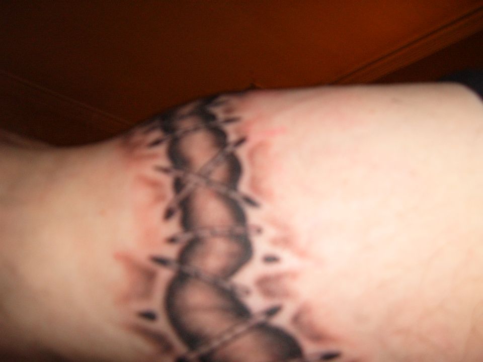 tattoo of a stitched wound on skin