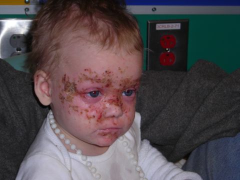 2003 Jeep TJ - A young child with visible facial injuries and a white beaded necklace is pictured.