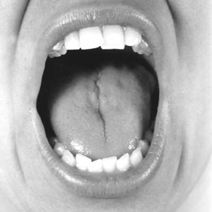 1991 Ford Bronco - A close-up view of a person's open mouth, revealing their teeth and tongue.