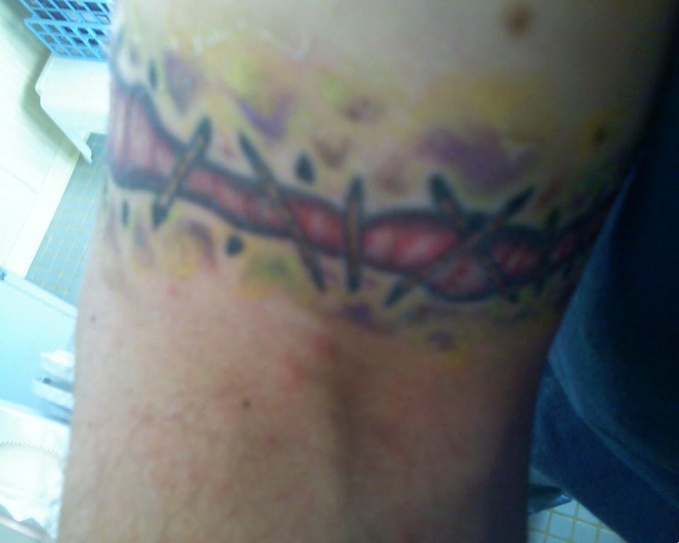 Tattoo of barbed wire with red and yellow coloring on an arm