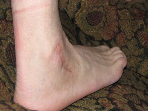 1986 Pontiac Fiero - Close-up of a human ankle and foot against a patterned background. Text 'SUPERMOTORS' visible at bottom right.