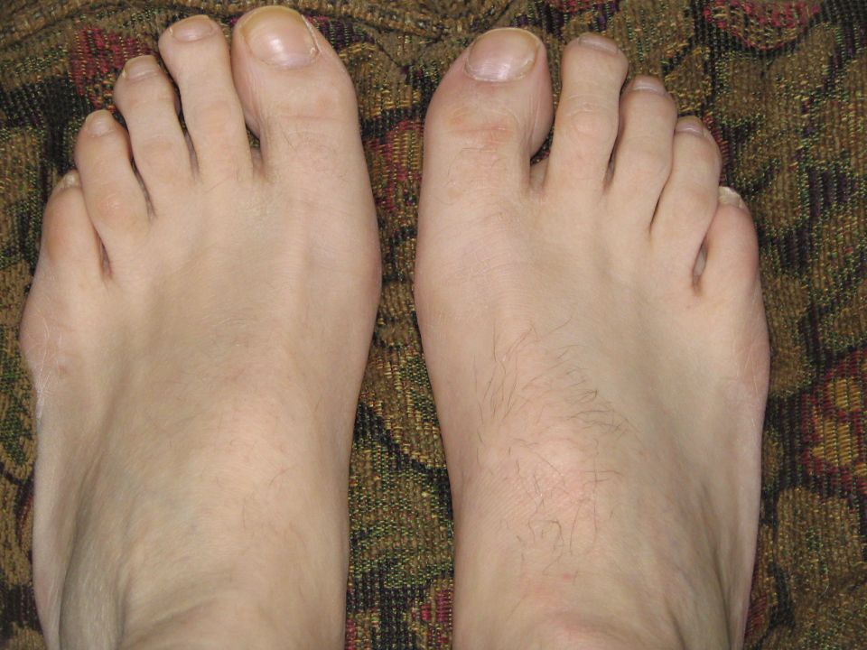 Two human feet with toenails and light hair on a patterned background. Supermotors.net logo in lower right