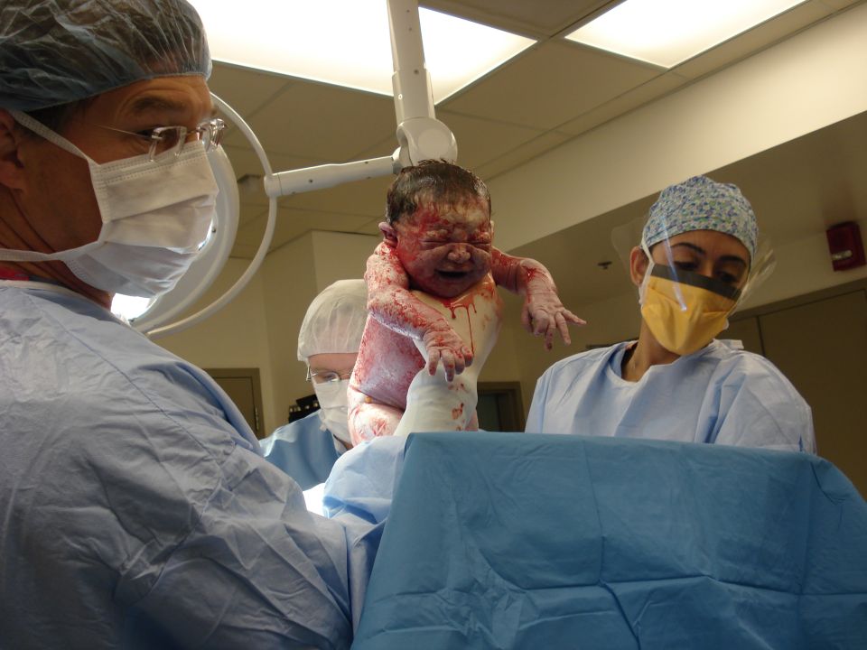 Newborn baby held up by medical staff in an operating room just after birth