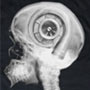 1998 Ford Crown Victoria - An unusual X-ray image shows a turbocharger superimposed over a human skull.