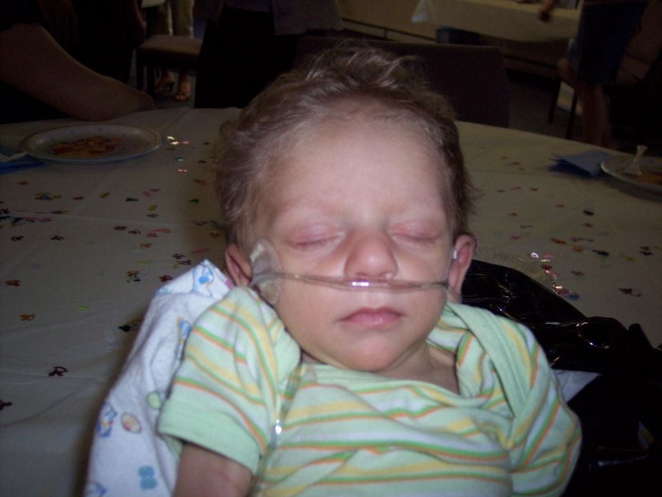 Child with nasal cannula sleeping at a table