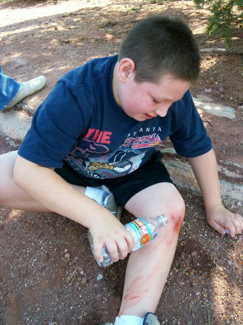 1993 Ford Bronco - Christian's injury while hiking