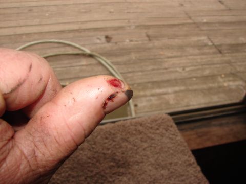 1973 Ford Ranchero - A close-up view of an injured thumb, showing a cut and blood, resting on a brown towel with a wooden deck in the background.