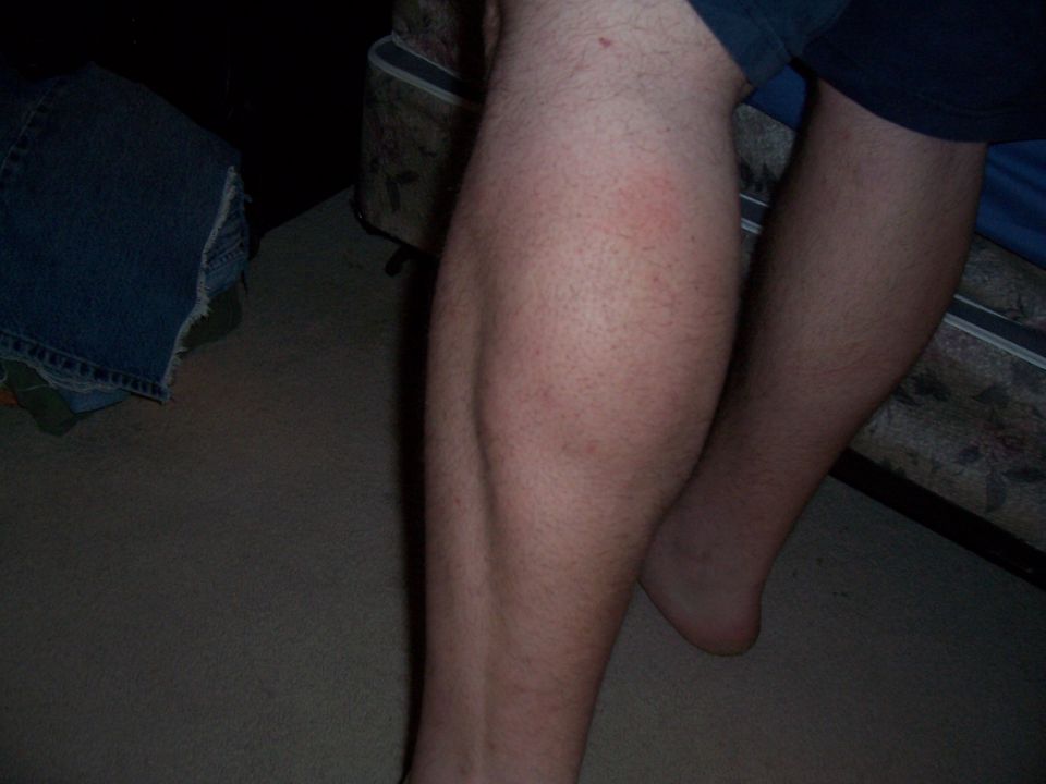 Close-up of hairy human legs and feet, with denim fabric visible on the left
