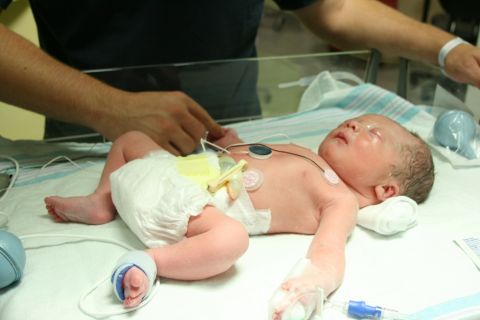 1988 Ford Bronco - A newborn baby is shown with medical monitoring equipment attached, lying in an incubator.