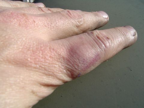 1978 Ford Bronco - Decided to hit my finger with the "Dead blow"
