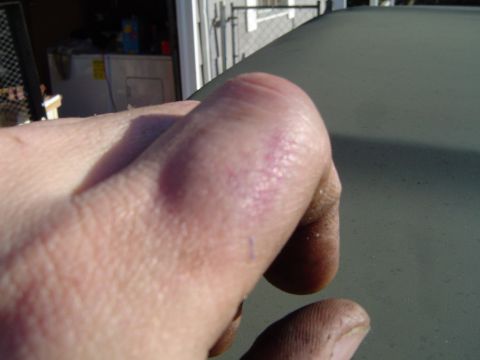 1978 Ford Bronco - A close-up view of a hand with a visible red mark on the thumb, set against a dark, textured background.