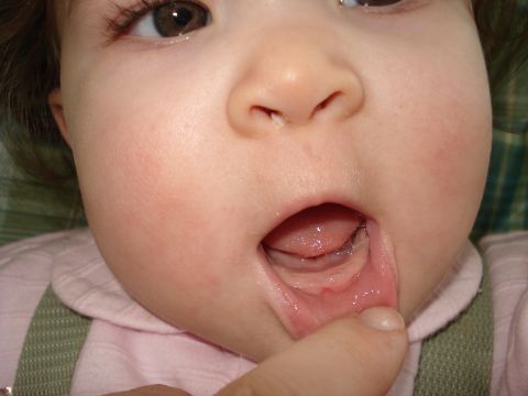 2000 Ford Crown Victoria - Emelia's 1st Tooth
