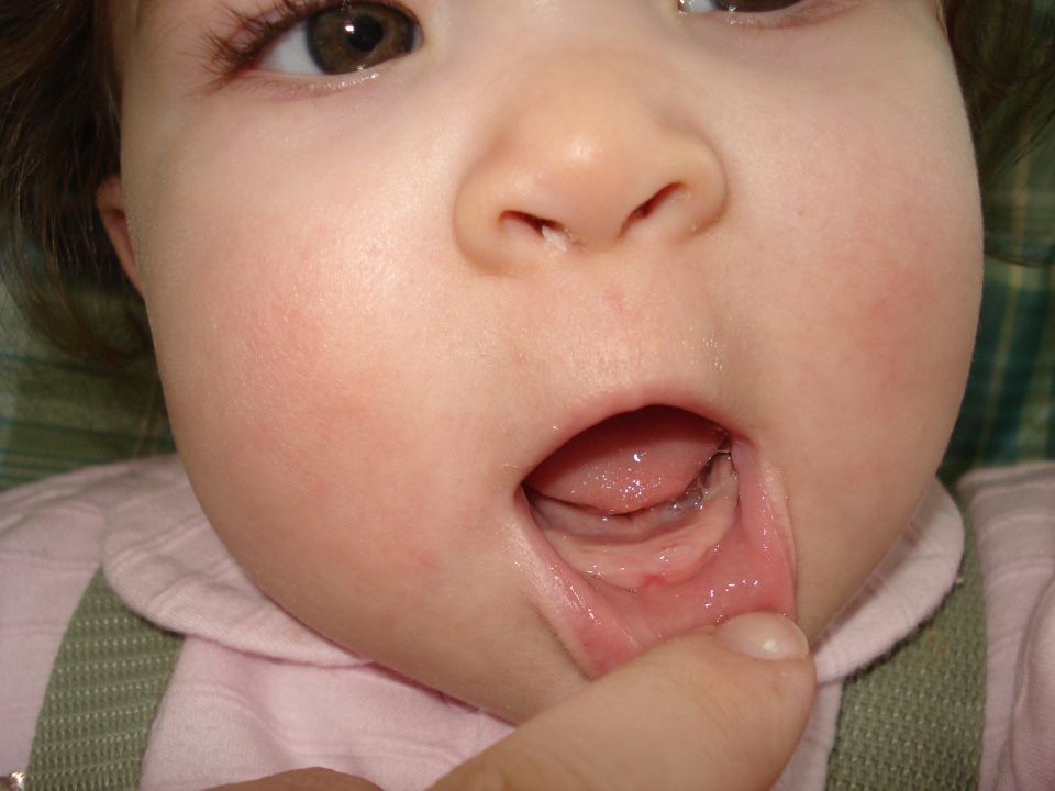 Emelia's 1st Tooth