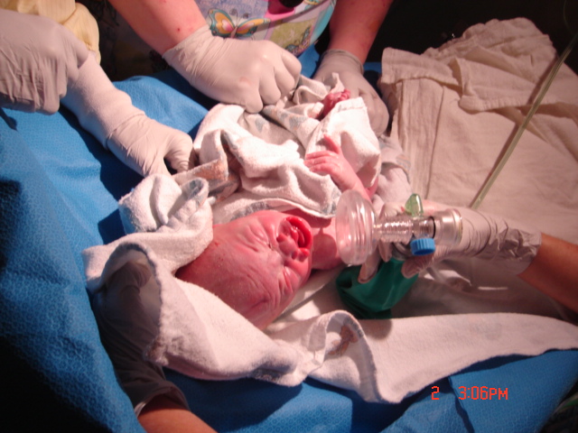 Newborn baby with medical equipment, possibly in a hospital setting. Text at bottom reads 'SUPERMOTORS.NET'