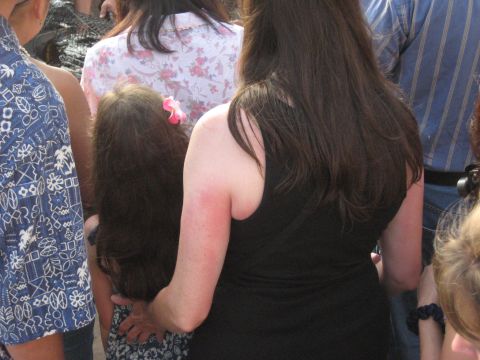 1991 Ford Bronco - A group of people are standing together, with one woman's arm showing a red sunburn.