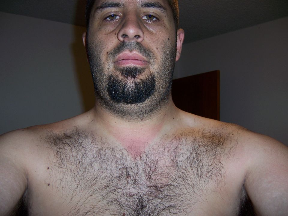 Man with beard and hairy chest, red mark on neck