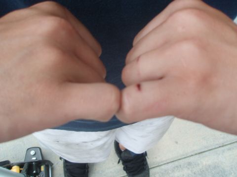 1987 Ford Bronco - A close-up shot of two hands, one with a small cut on the knuckle, against a dark blue shirt and white shorts.