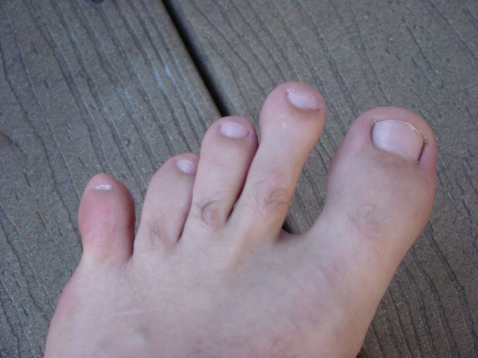 Human foot with five toes, showing toenails and skin texture against a wooden surface. Text overlay reads 'SUPERMOTORS www.supermotors.net'